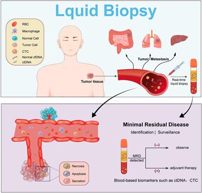 Minimal residual disease (MRD) detection in solid tumors using circulating tumor DNA: a systematic review